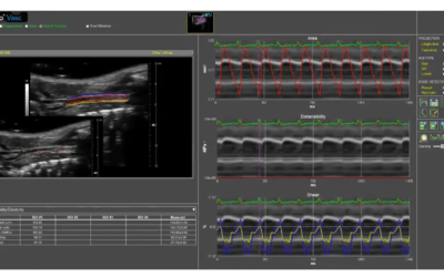 Strumedical ha partecipato al webinar “Measuring vascular stiffness in aging mice using high resolution vascular ultrasound”, Dicembre 2020, organizzato da Fujifilm Visualsonics.